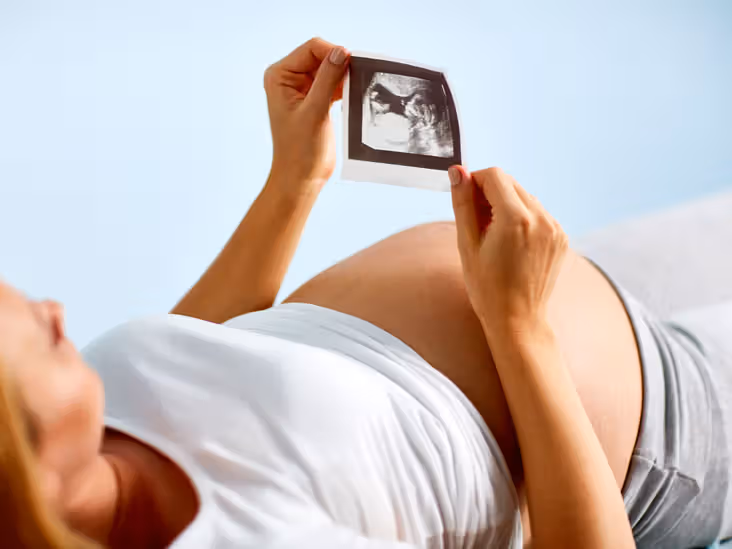 3D/4D Sonography